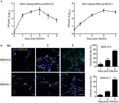 Proteomic Analysis of Zika Virus Infected Primary Human Fetal Neural Progenitors Suggests a Role for Doublecortin in the Pathological Consequences of Infection in the Cortex